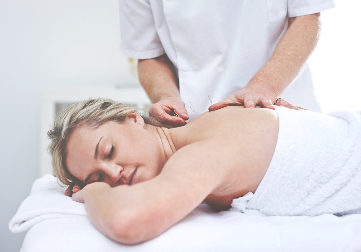 A young woman getting needles inserted into her back during an acupuncture session. A patient getting alternative therapy for medical treatment